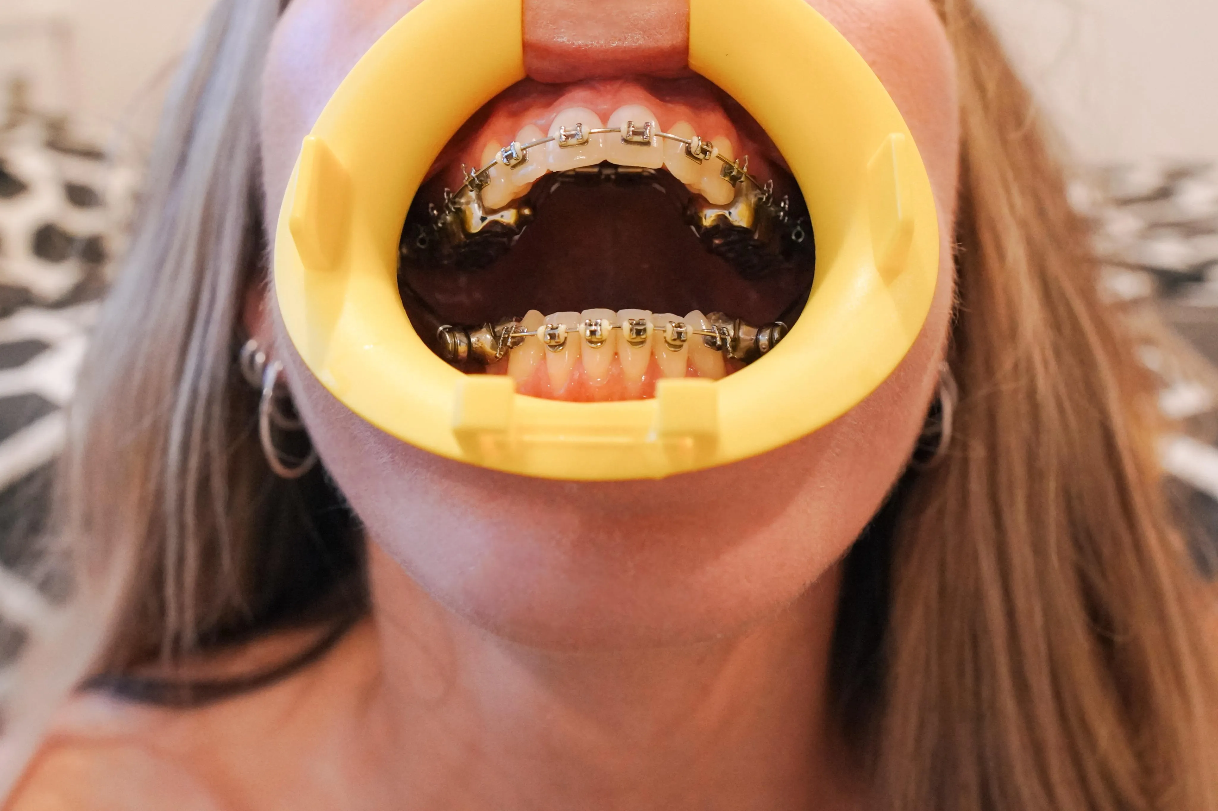 You don’t even wanna know how hard this was to get in. Or maybe you do? That’s probably more likely