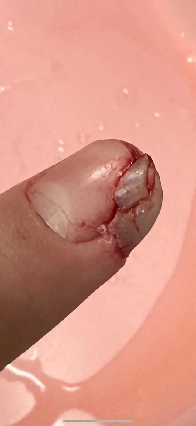 Damn near chopped it off