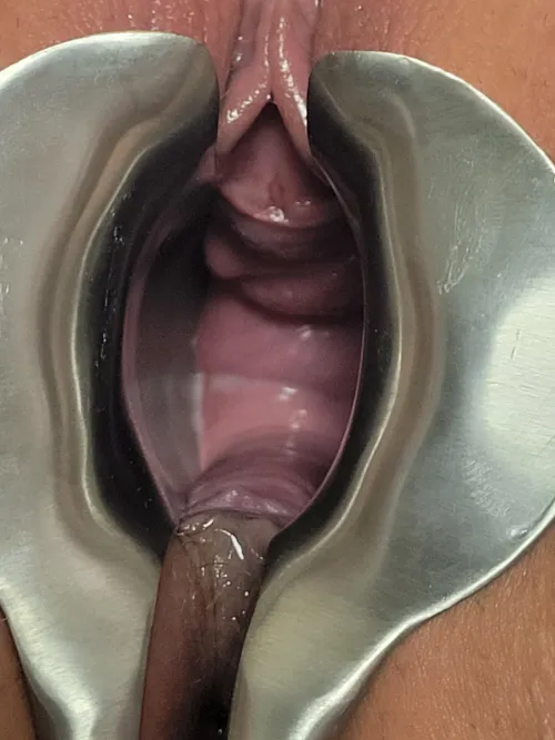 First time using the speculum