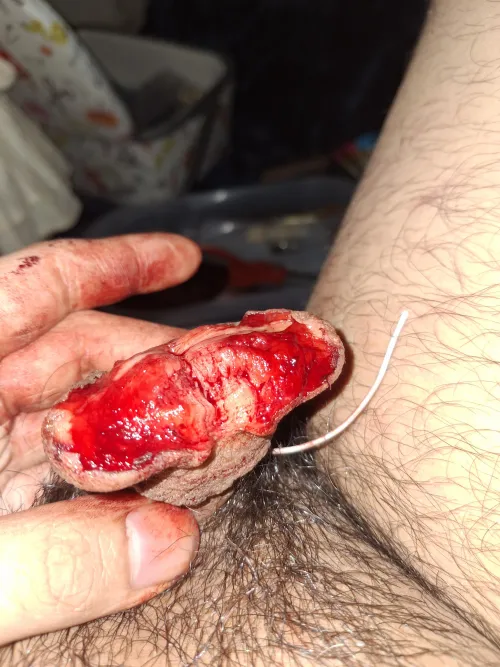 Go big or go home I guess?