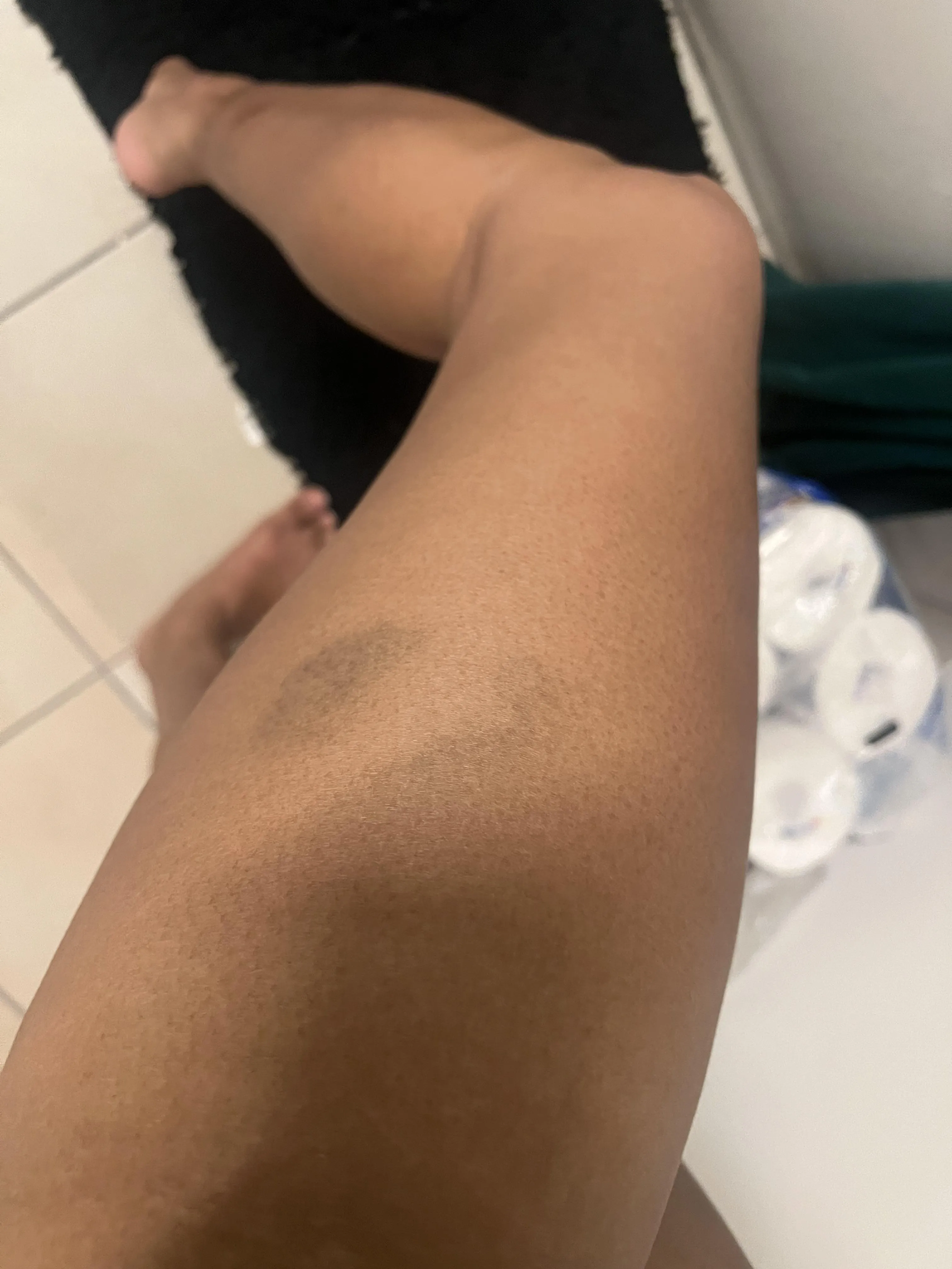 His mouth mark is on my leg 🥵 I taste so good