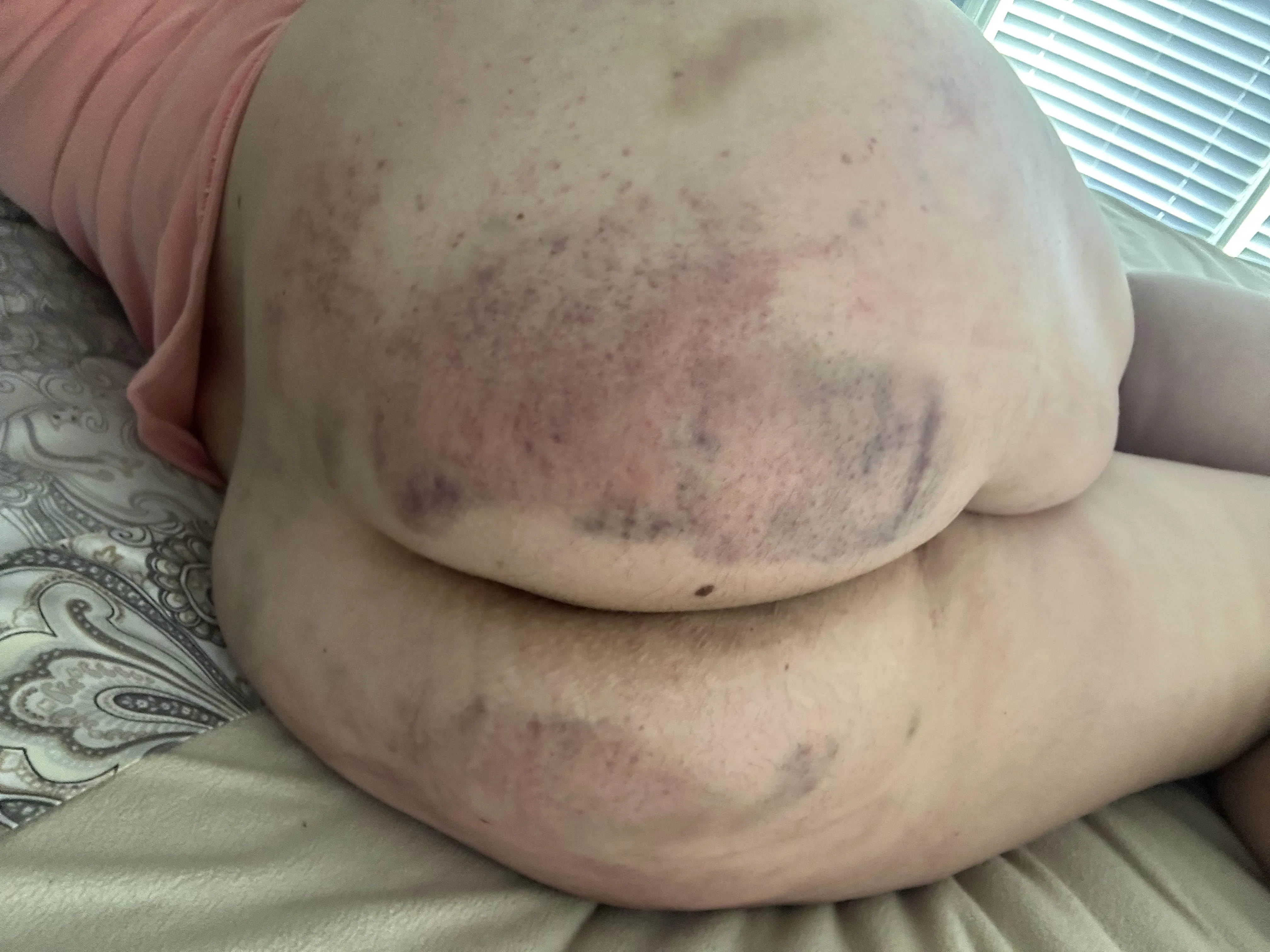 The morning after. I think I will behave and be a good girl. At least for a little while!