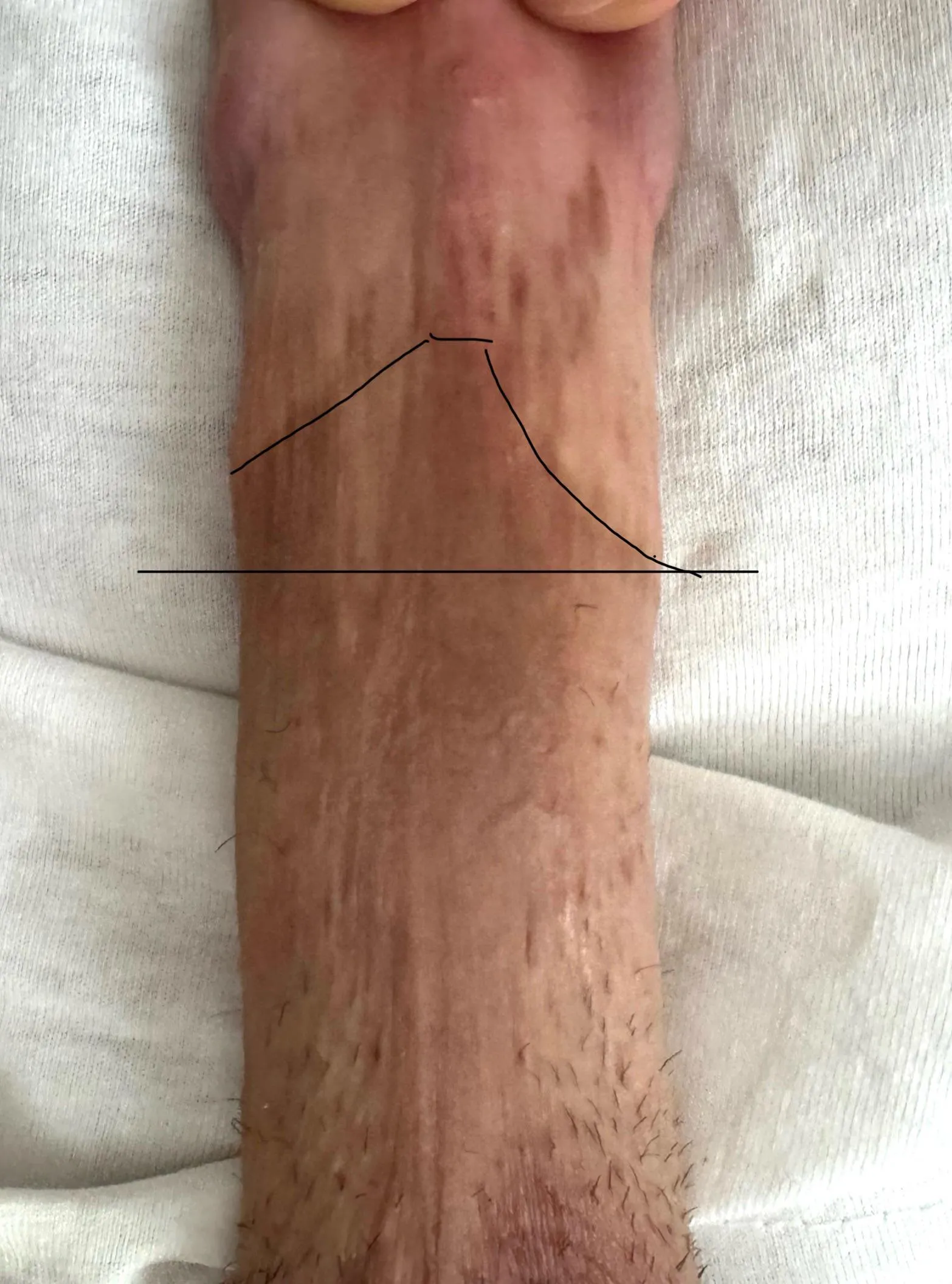 Vorteile der Freihandtechnik 😂