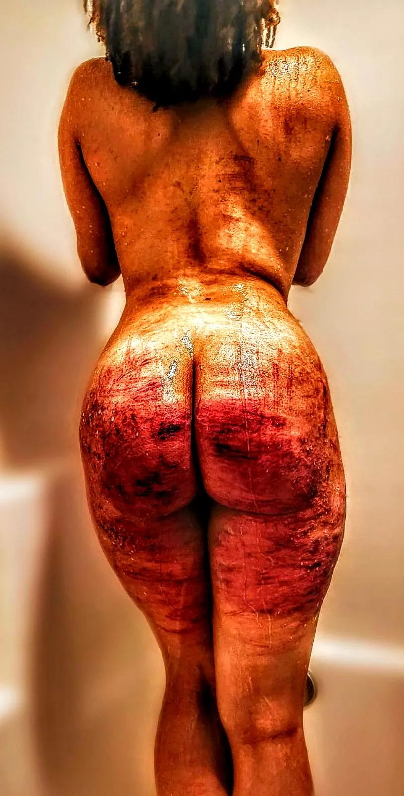 What hurts you, blesses you. Darkness is your candle