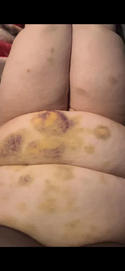 Beautiful progression