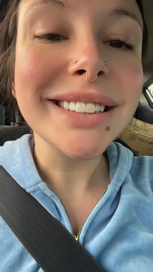 Finally got my Barbie teeth!!!