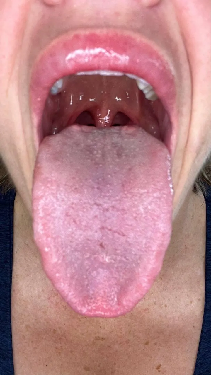 here, jump in and descent {f}