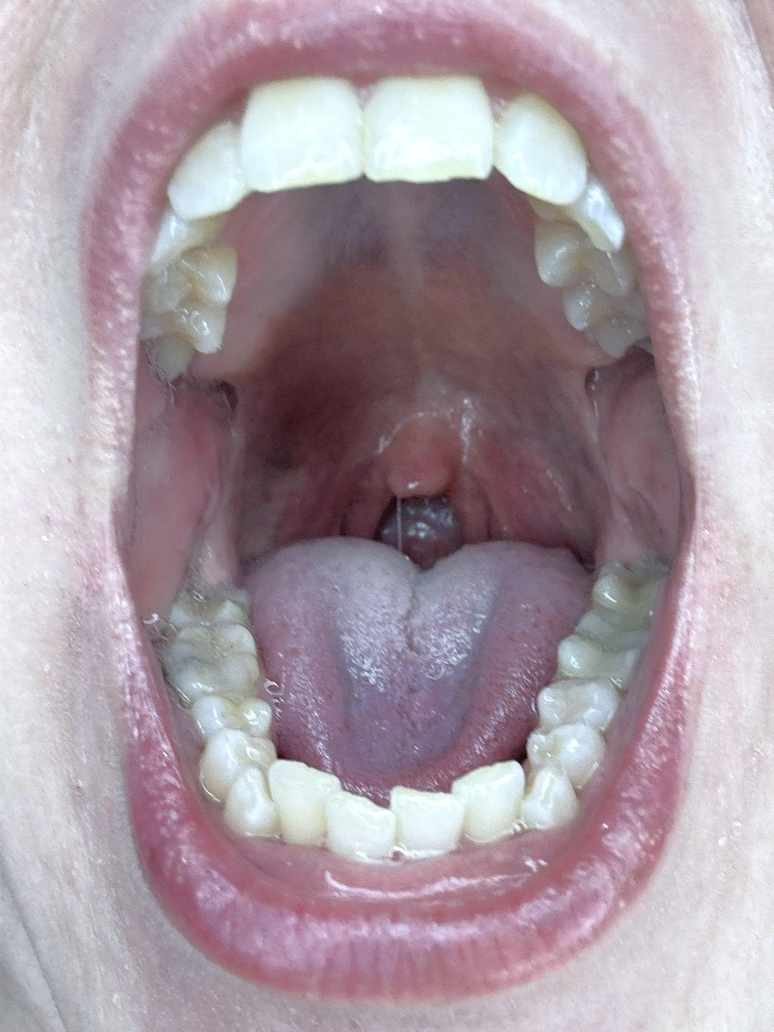 Hungry throat, always ready to devour you {f}