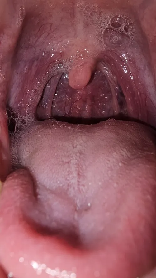 {M} Wet and waiting for you