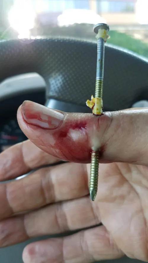 My dad was trying to teach some kids how to use a nail gun