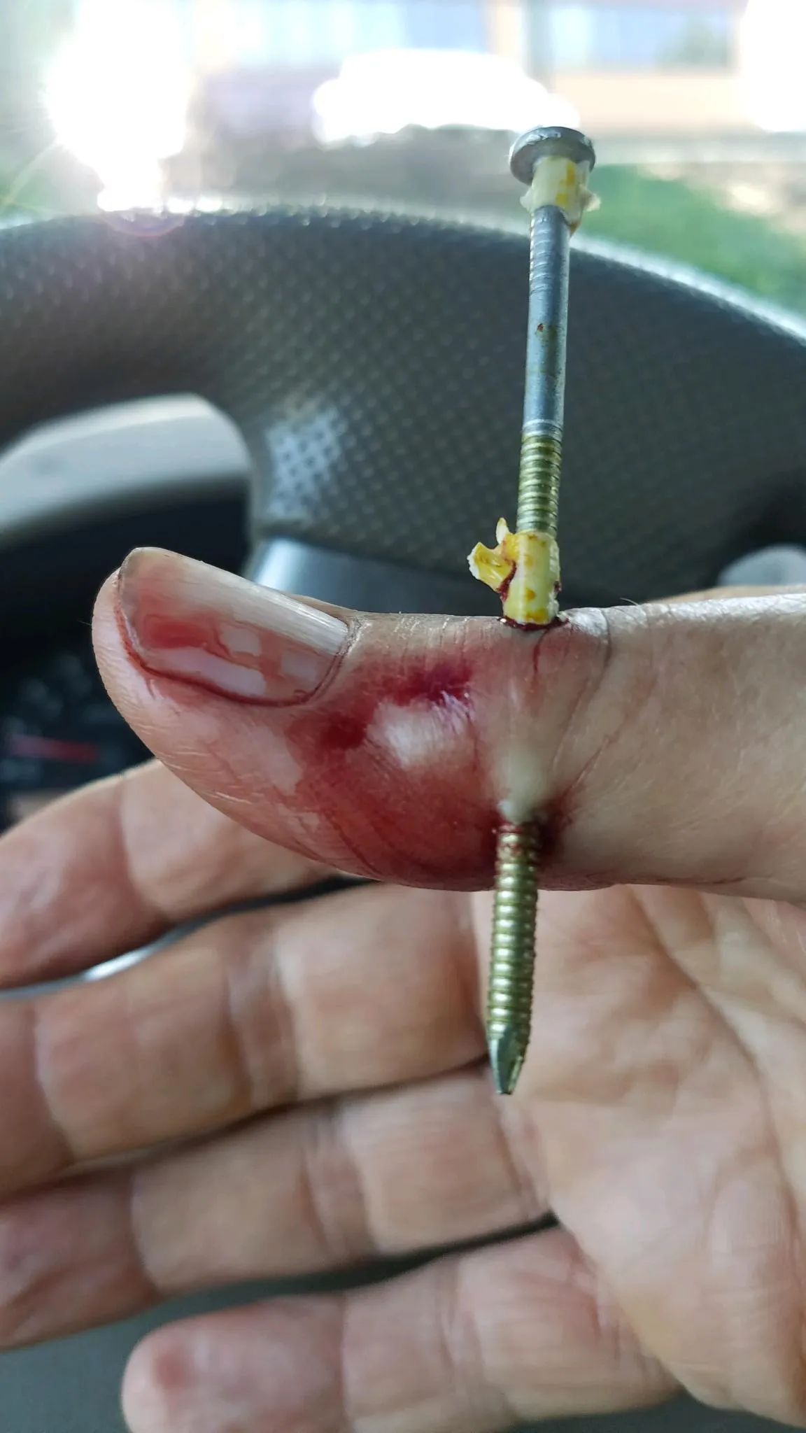 My dad was trying to teach some kids how to use a nail gun