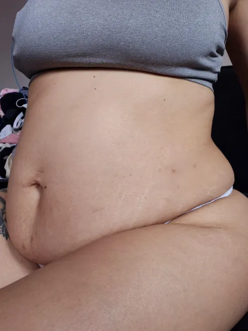 Full of white stretchmarks