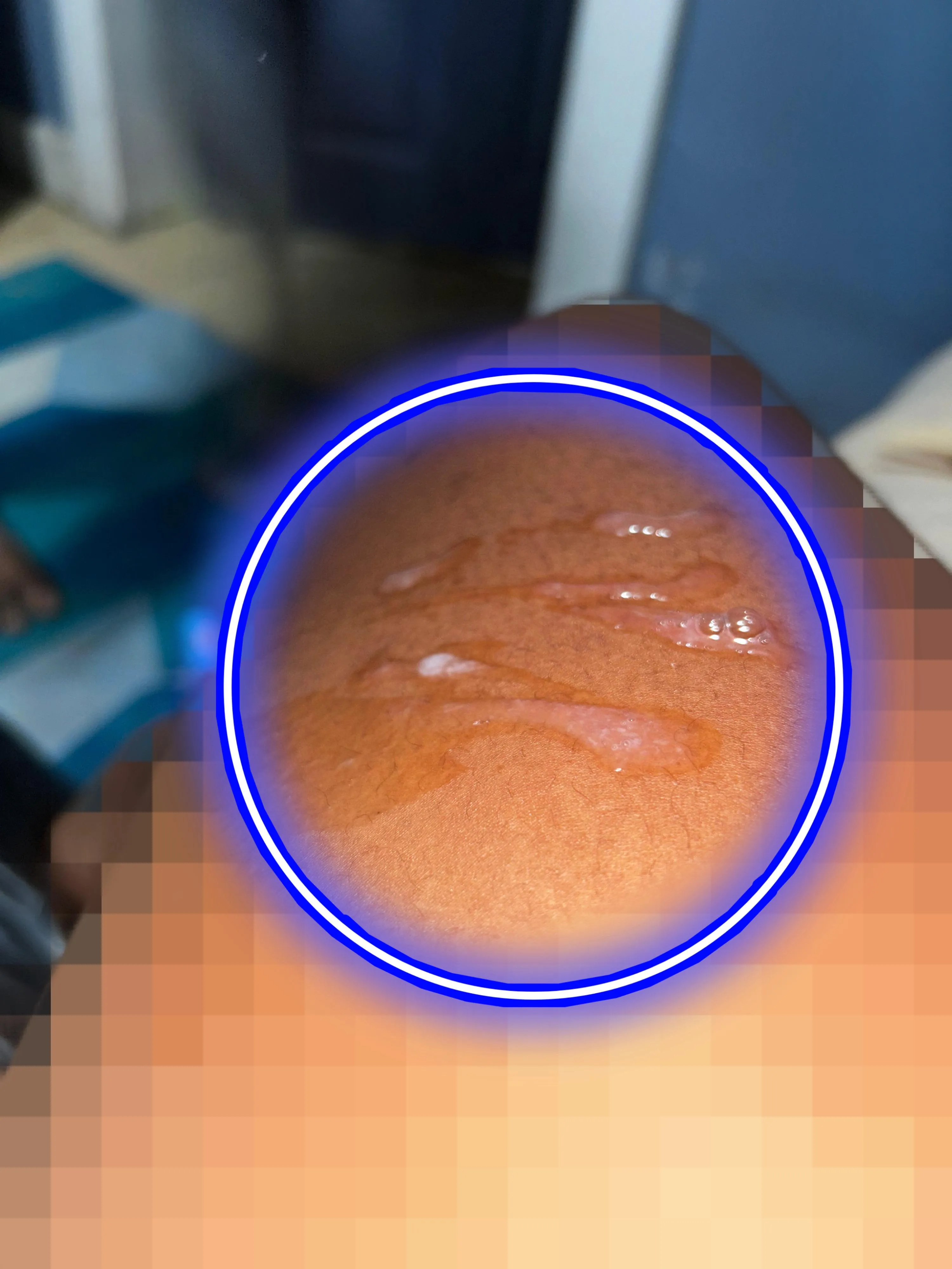 Here’s your midnight treat lick it up from my superior inner thigh🔥!