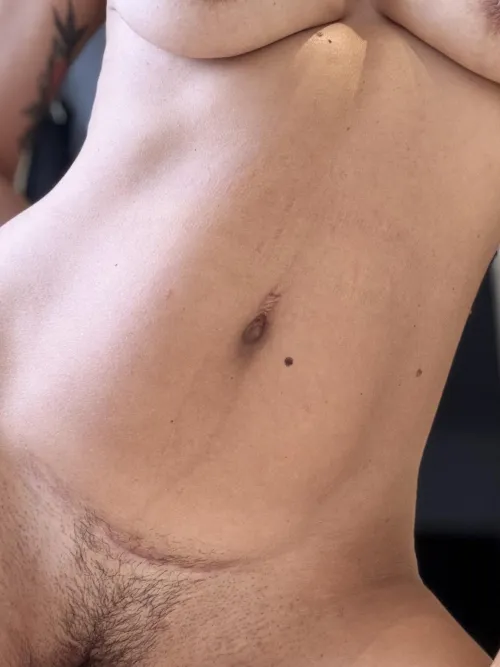 3 scars, worn with pride