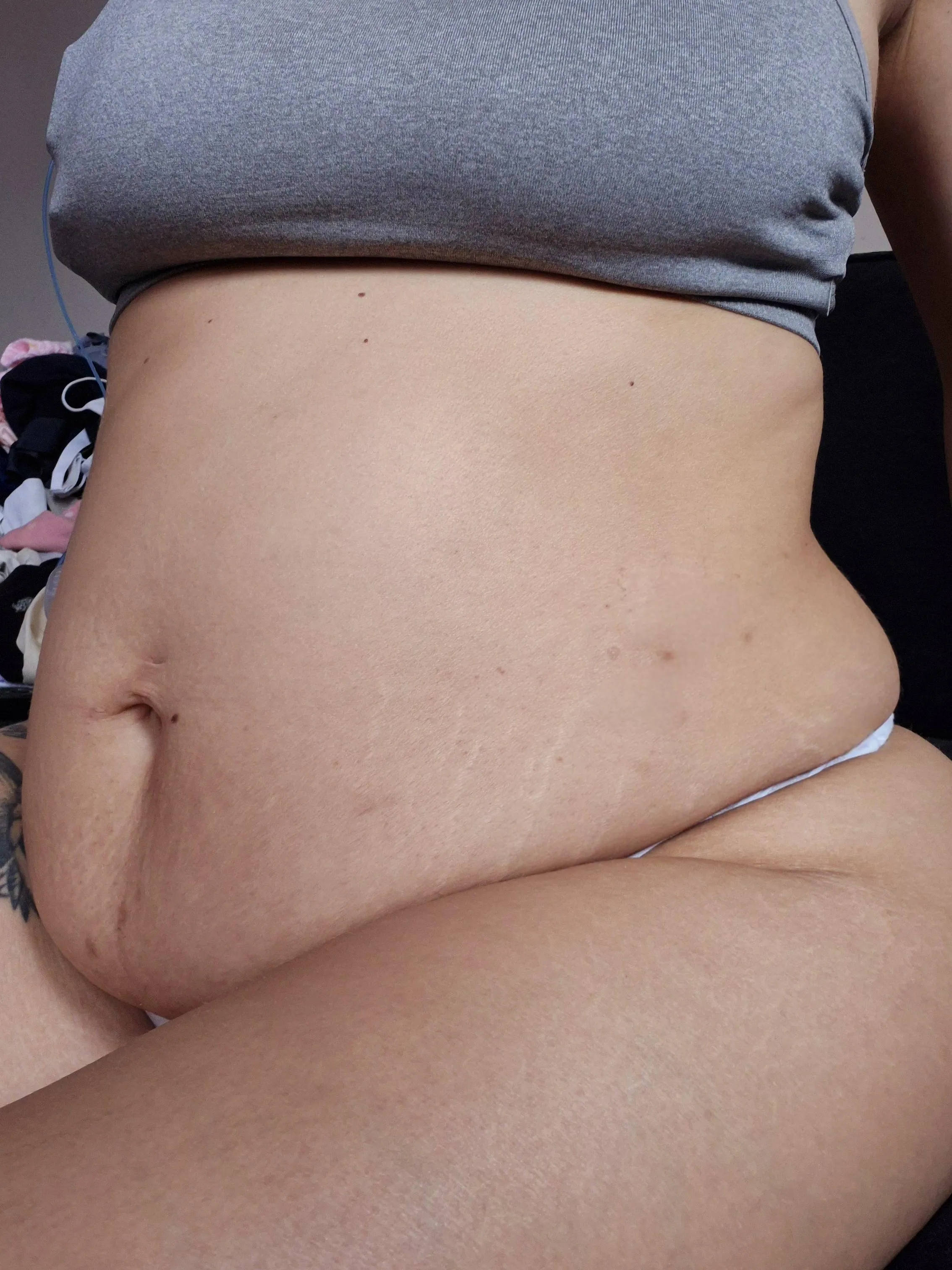 My little white stretchmarks