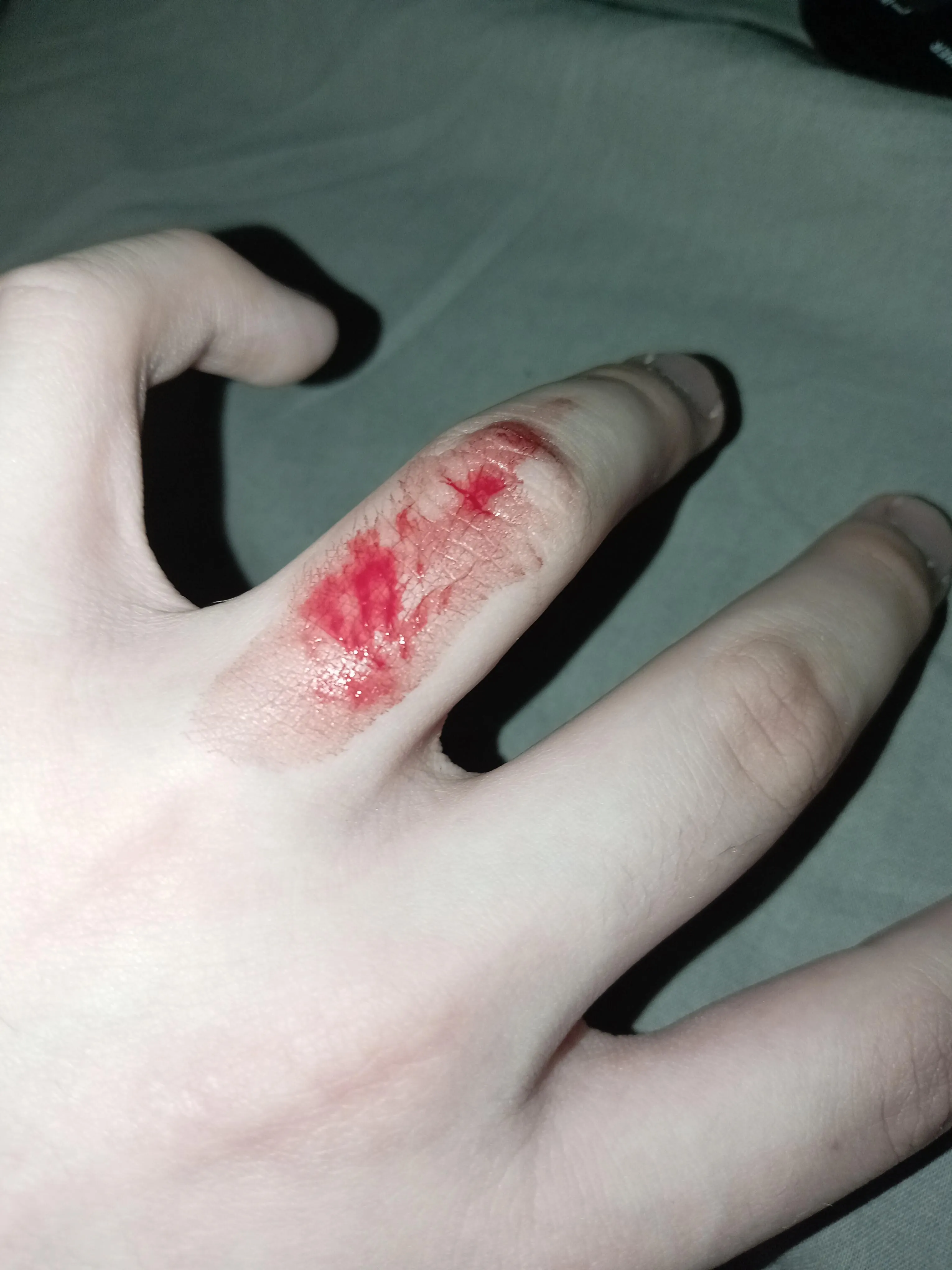 I was flipping a knife up in the air like the dumbass I am and uh..