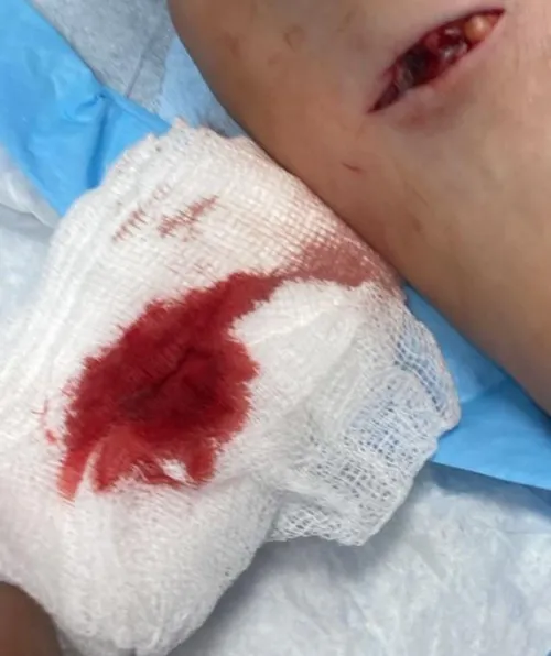 It was 2 days ago. It still hurts so bad