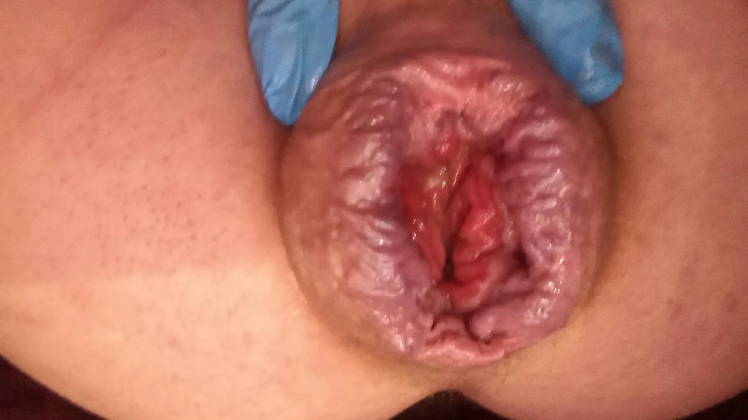 I was on my period so I agreed to anal 🙄🥵