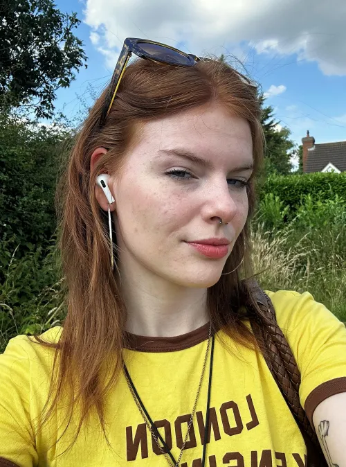 just serving the freckles