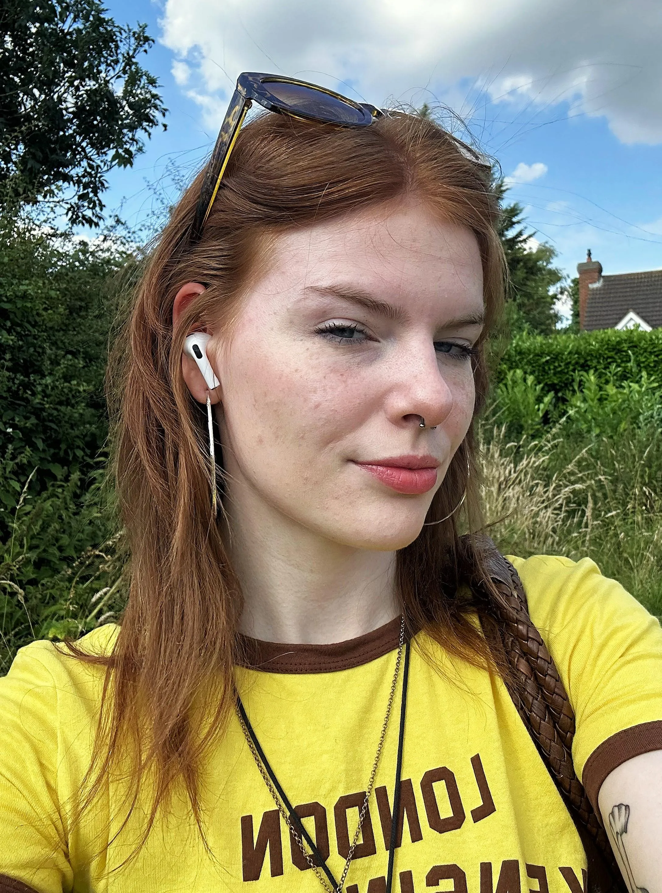 just serving the freckles