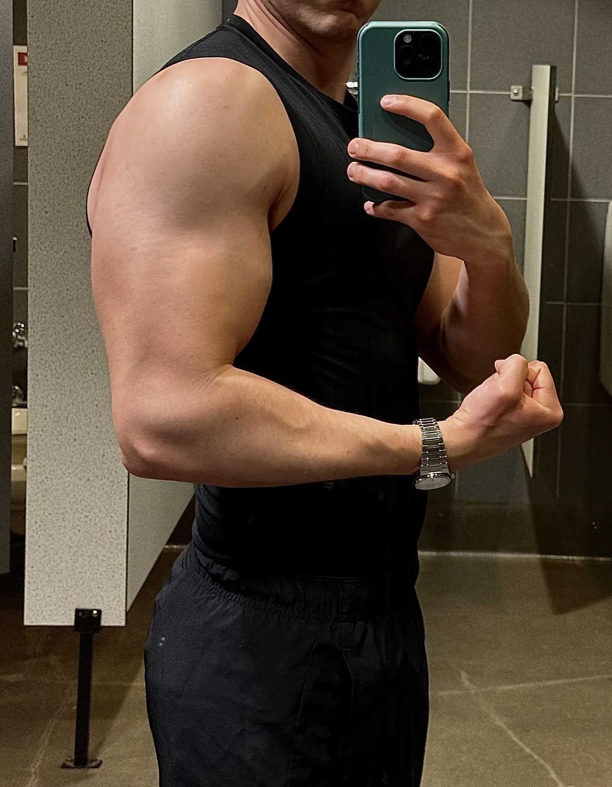 Arms are growing