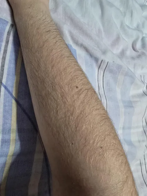 Friendly [arms] hairs, what do you think?