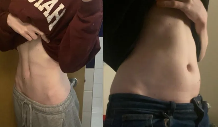 I’m still fashion model skinny right?! 😅😅