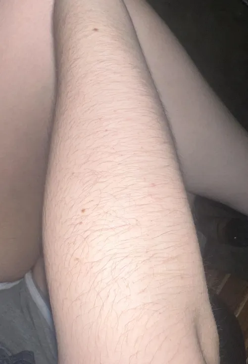 my [arms] are getting so fuzzy!!