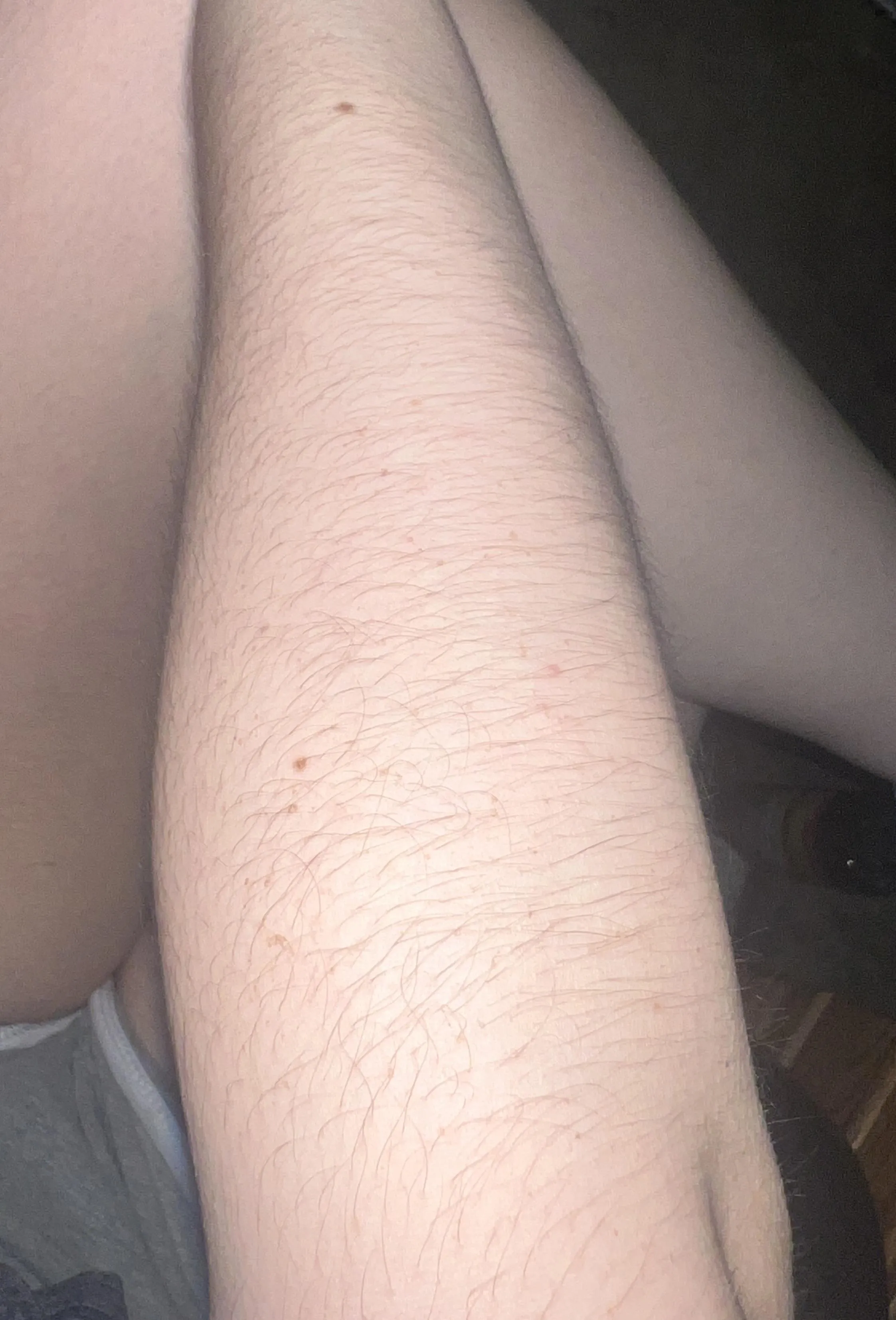 my [arms] are getting so fuzzy!!