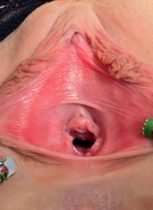 Let’s stretch the limits… literally. 😉 I answer on IG.