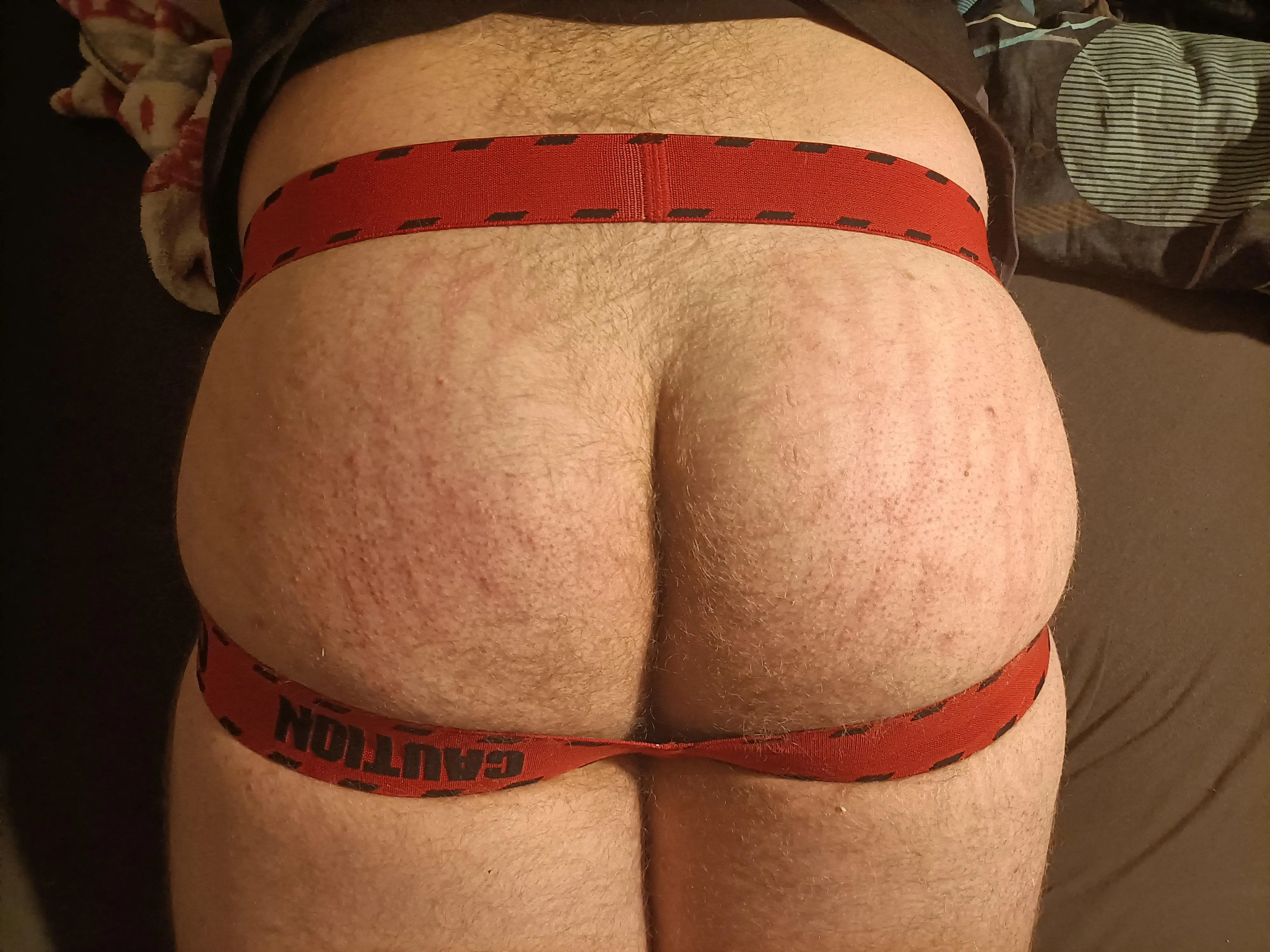 o no... what happened to pup pablito's bum bum... 😈 got scratches all over...