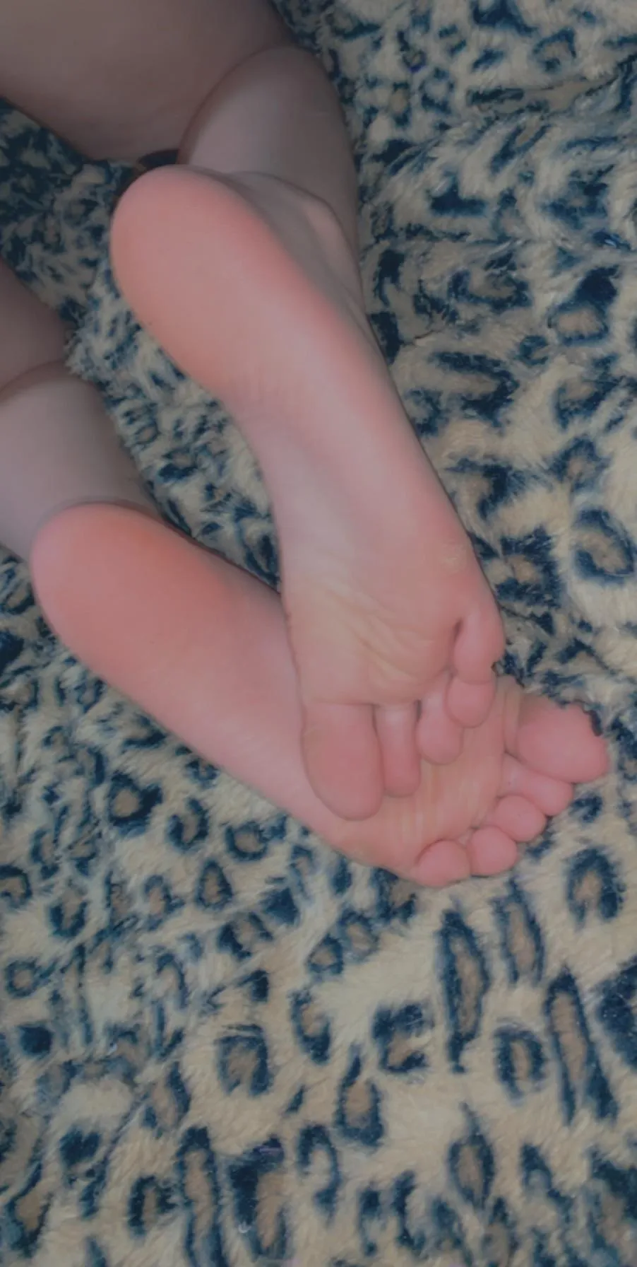 Would you kiss these?