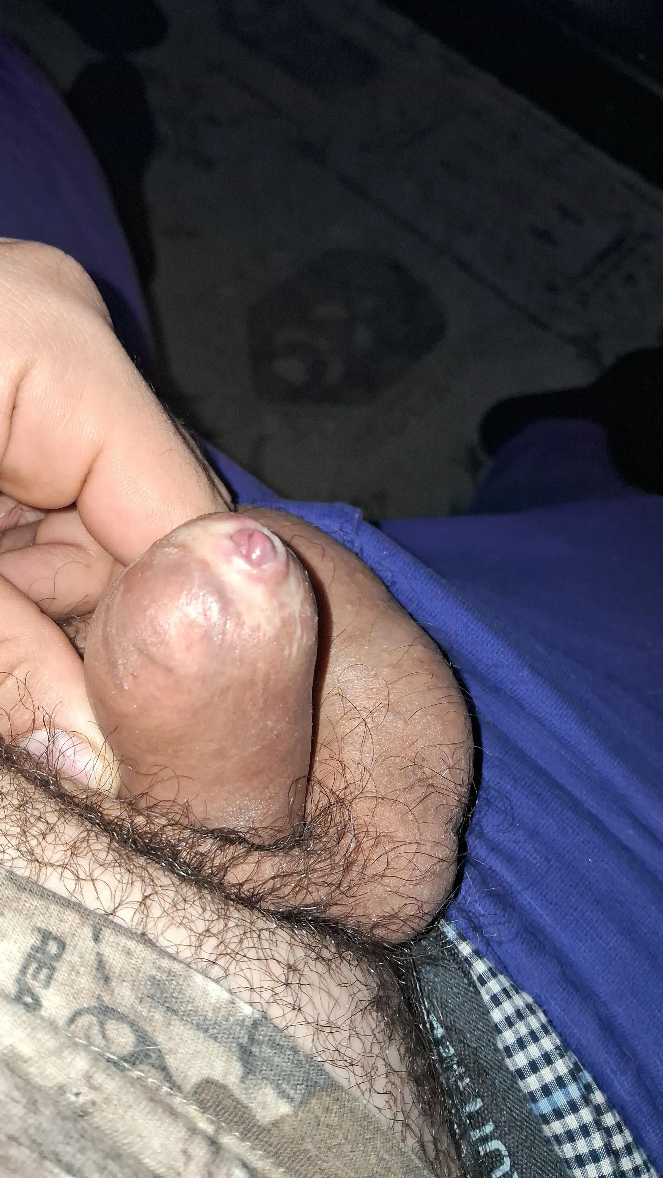 My doctor said i need to be cut, what you think. This is soft and i cant go down