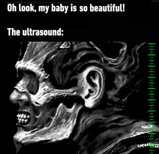 Squelching Flesh — Psychic Incarceration