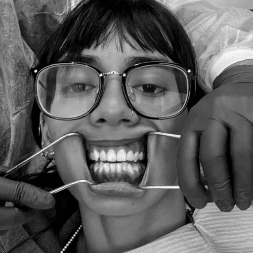 The dentist will always make you look like a freak