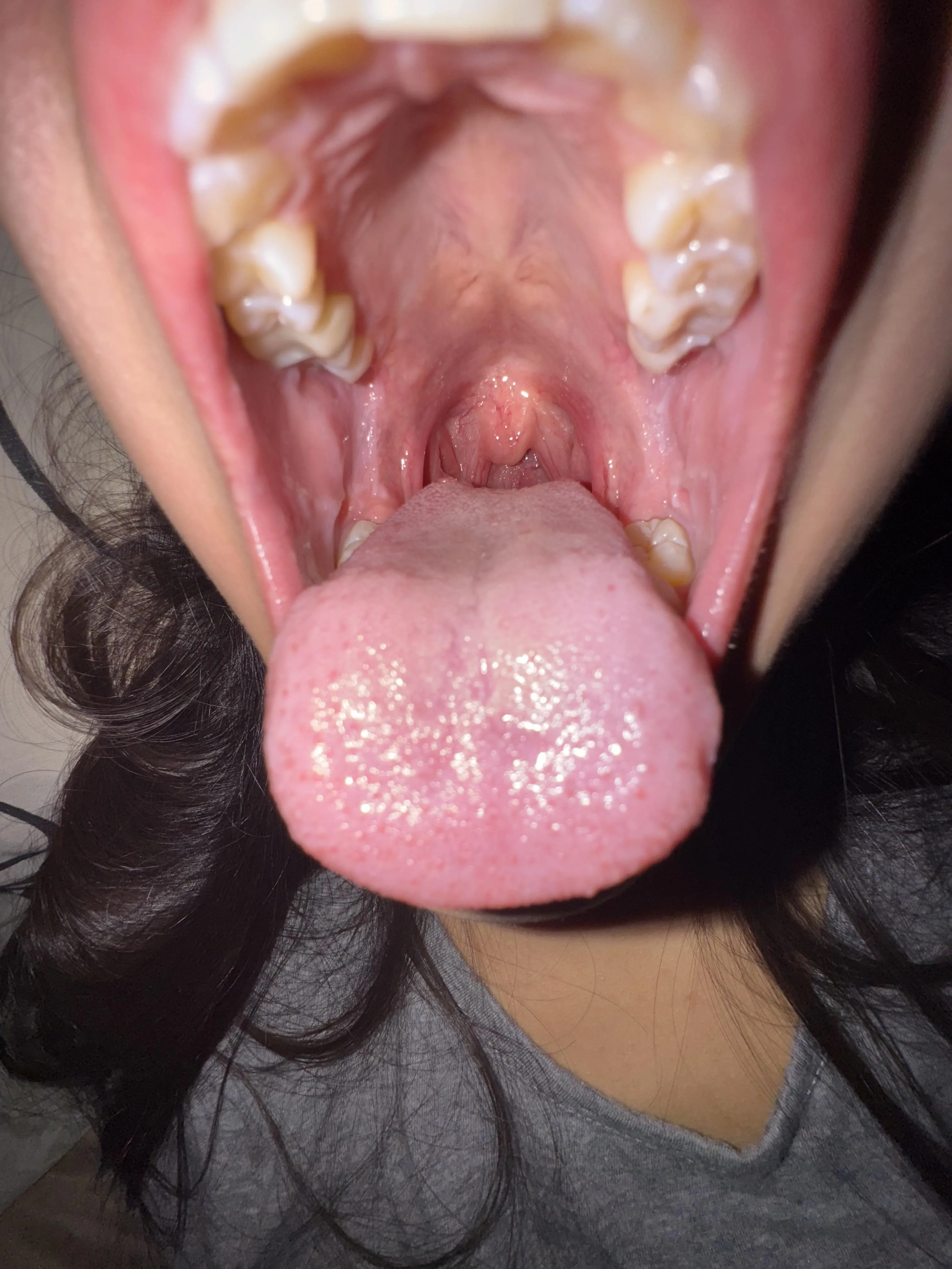 You're going to fall into my throat like when you threw yourself off the slide as a child