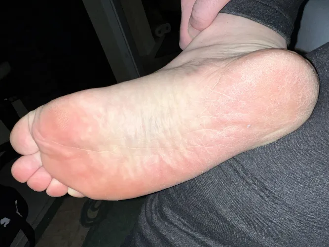 Fresh from the shower 😉