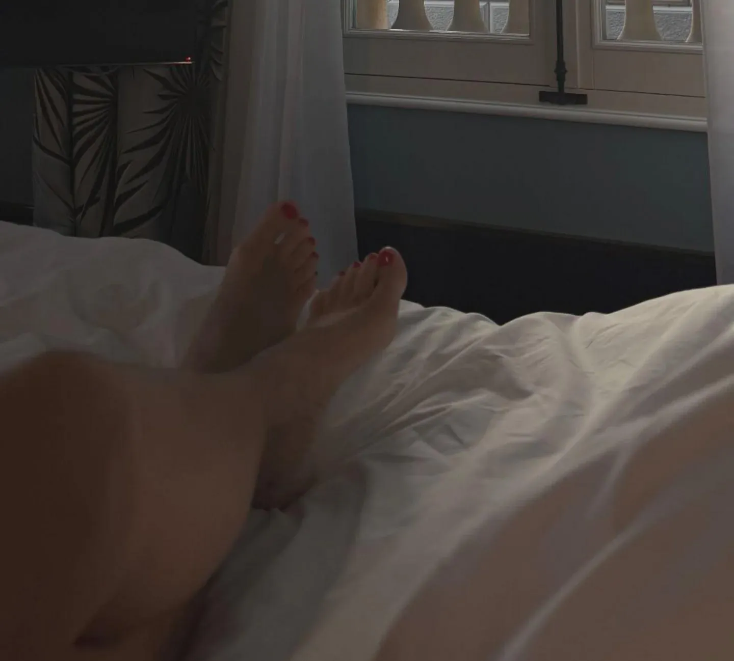 Pies de ester en Francia