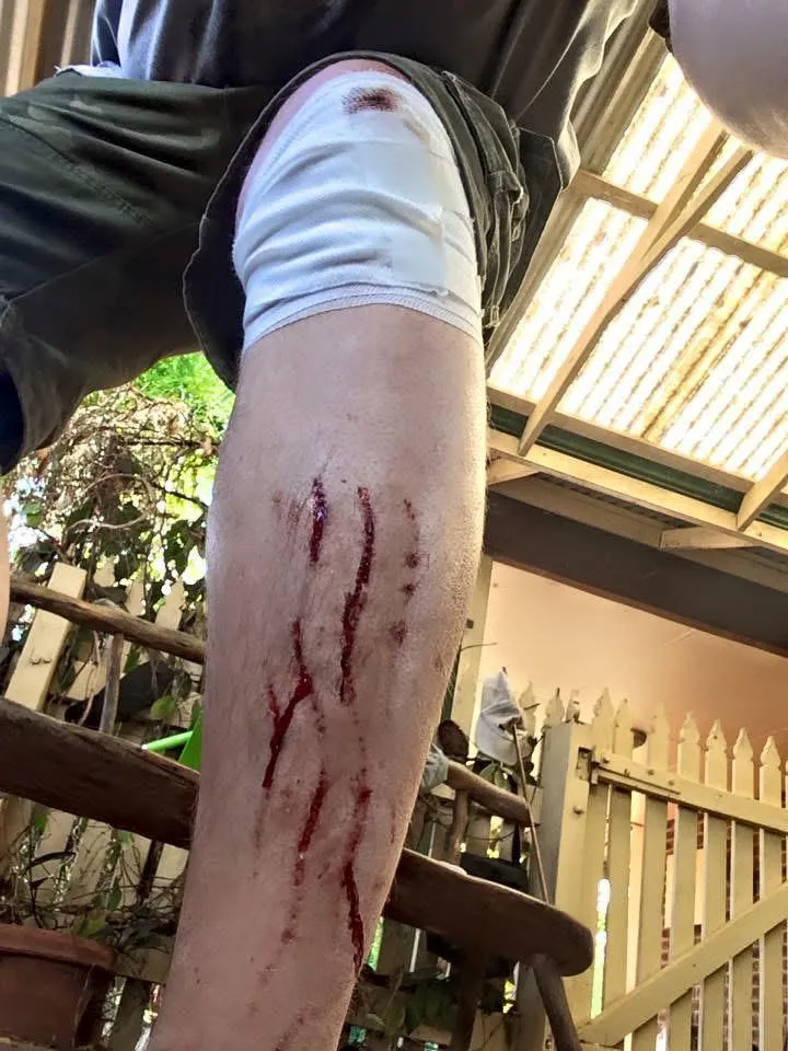 Bear swipe(not really, just an escalator wound)