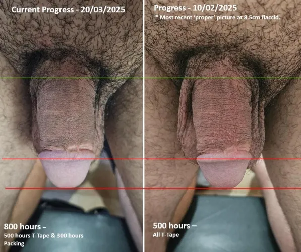 800 hour mark. Been focusing on inner skin using packers. I know it will take much more time to grow any skin, but feeling slightly discouraged. I feel like going back to T-tape to grow more outer skin so my packers are easier to put on. Then focusing on