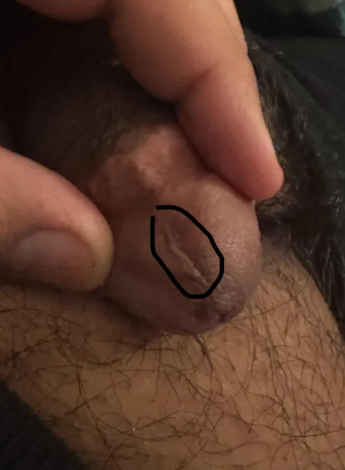 How do I remove this?