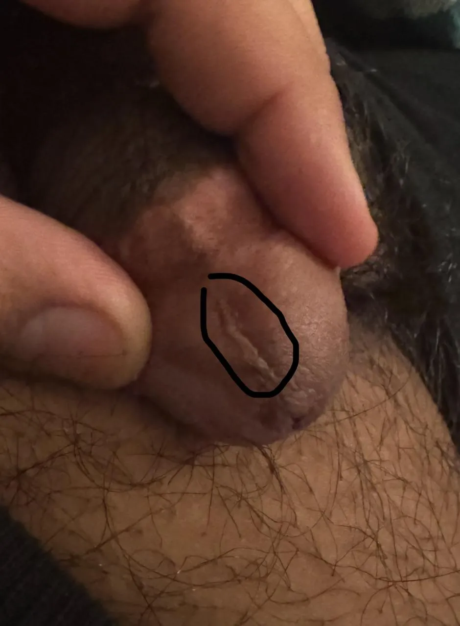 How do I remove this?