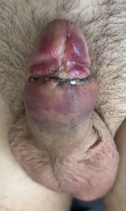 Much likelihood of any fren remaining? (Cut 4 days ago)