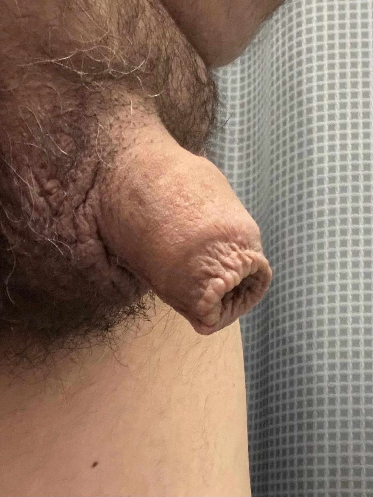 My Foreskin