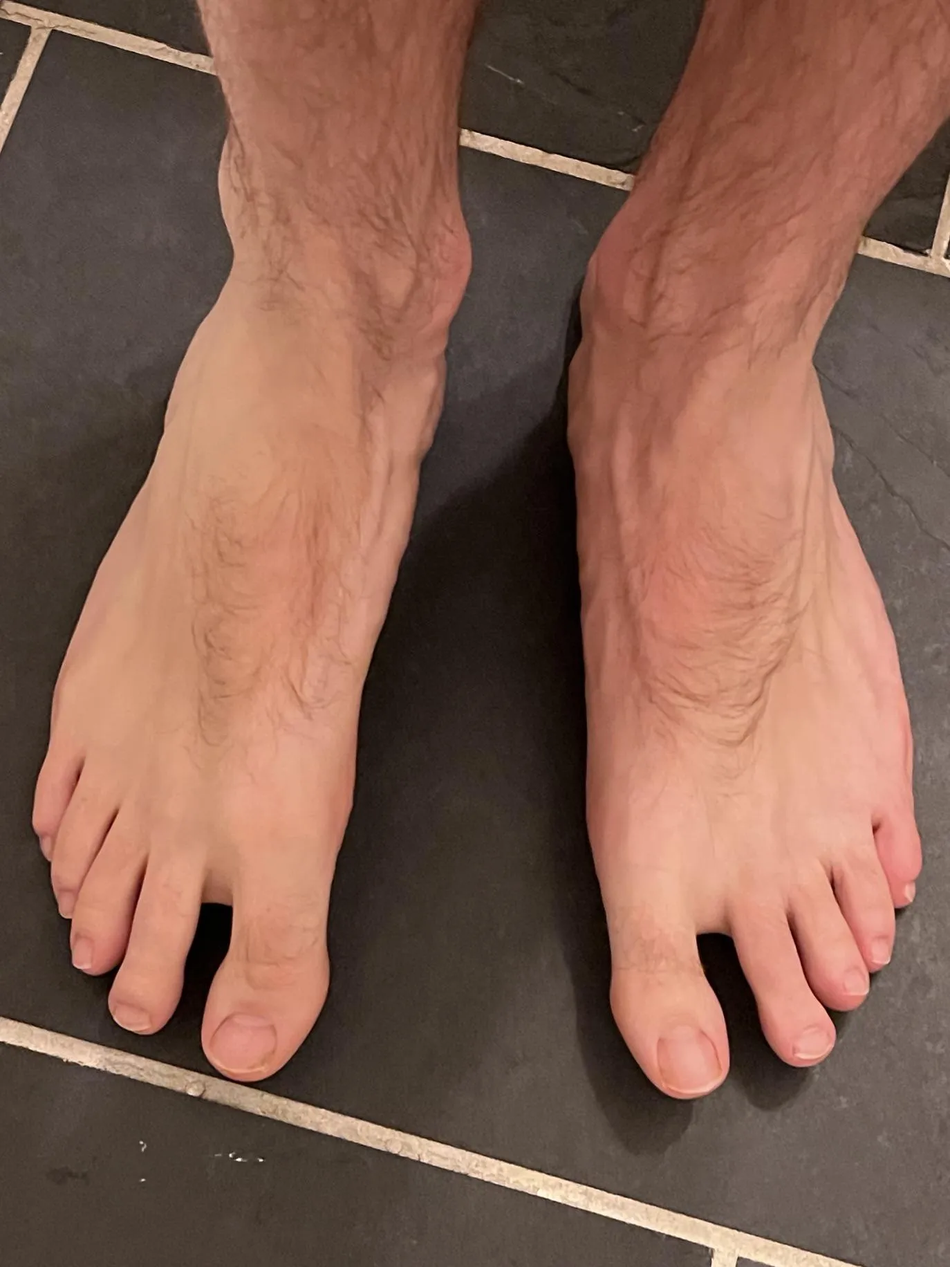 Who likes my hairy feet?