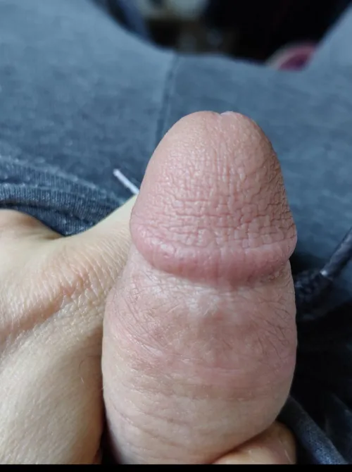 Head looks kinda rough...