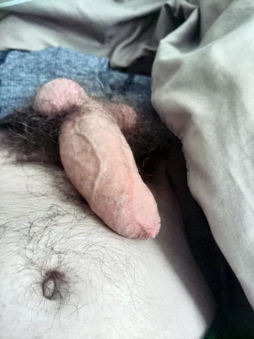 Some of my body hair is visible [33]