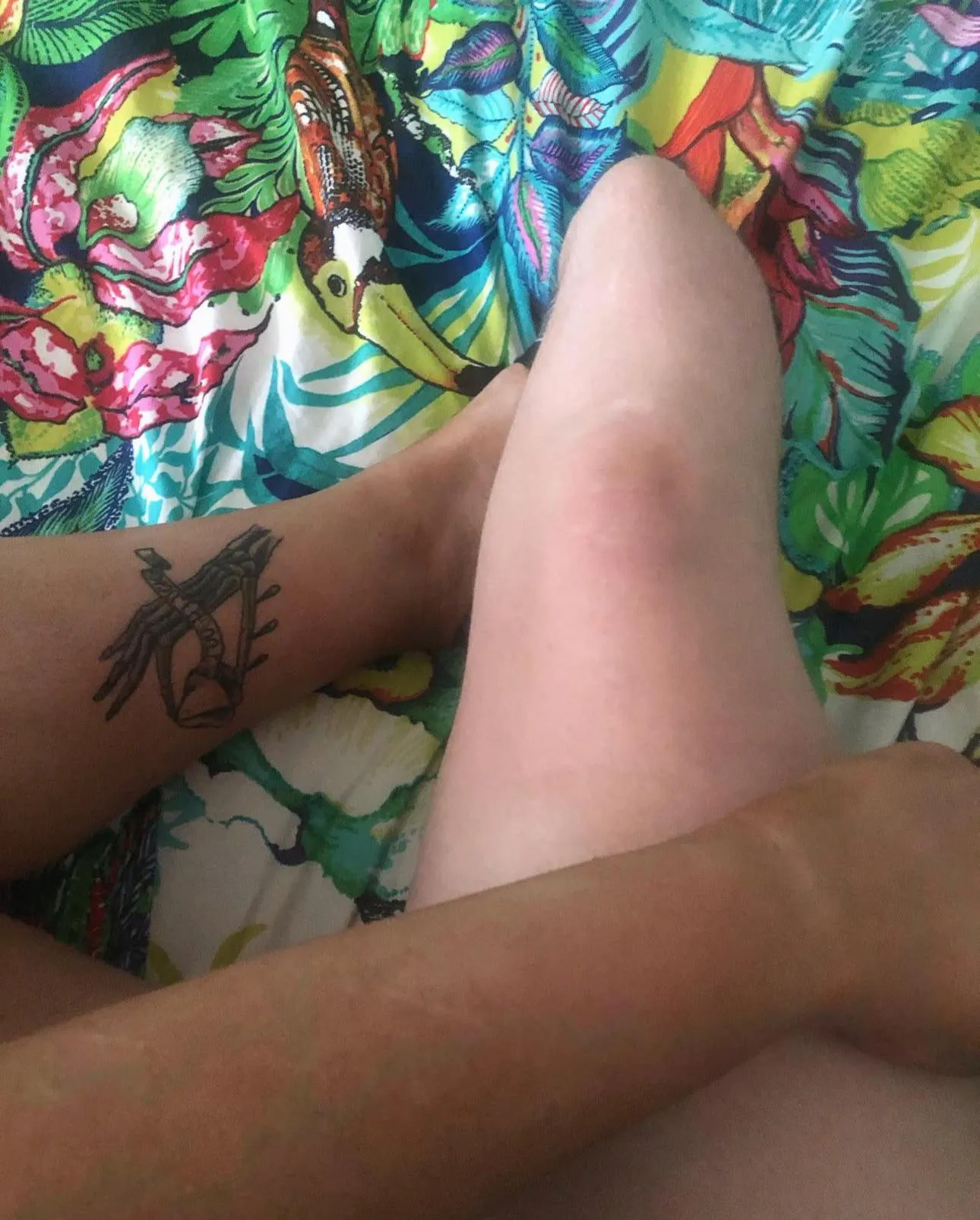 Stump tan lines 🙈😂