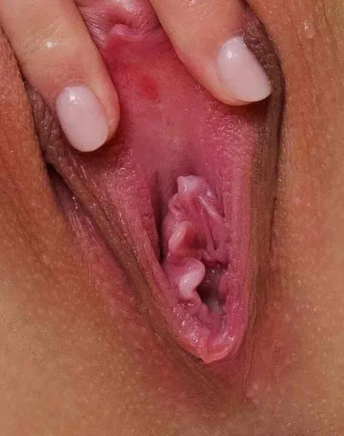 Sexy little curlicued hymenal tags