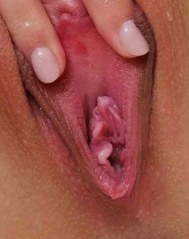 Sexy little curlicued hymenal tags